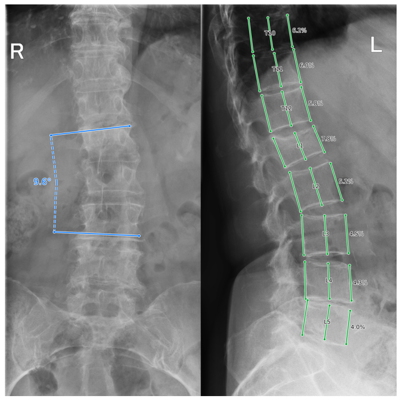 HealthSpine preview
